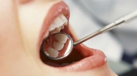 Что бывает у зуба?