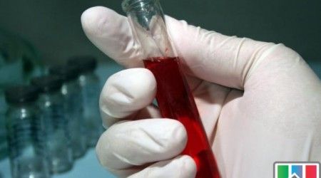 Какой плазменный фактор свертывания крови отсутствует в крови больных гемофилией?