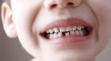 Какие зубы у детей меняются первыми?